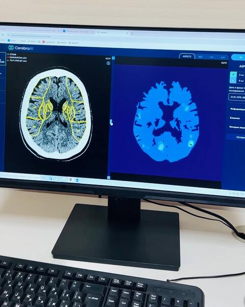ШЫМКЕНТ МЕДИЦИНАСЫНДА CEREBRA ЖАСАНДЫ ИНТЕЛЛЕКТ ЖҮЙЕСІ ЕНГІЗІЛУДЕ