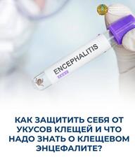 КАК ЗАЩИТИТЬ СЕБЯ ОТ УКУСОВ КЛЕЩЕЙ И ЧТО НАДО ЗНАТЬ О КЛЕЩЕВОМ ЭНЦЕФАЛИТЕ?