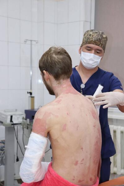 ВРАЧИ СПАСЛИ МУЖЧИНУ С ОЖОГАМИ ПОЧТИ 90% ТЕЛА ПОСЛЕ ВЗРЫВА ГАЗОВОГО БАЛЛОНА