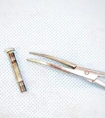 ВРАЧИ ТУРКЕСТАНСКОЙ ОБЛАСТНОЙ ДЕТСКОЙ БОЛЬНИЦЫ СПАСЛИ ЖИЗНЬ 1-ЛЕТНЕМУ РЕБЕНКУ, ВЫТАЩИВ БОЛТ ИЗ ГОРТАНИ