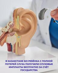 В Казахстане 523 ребёнка с полной потерей слуха получили слуховые импланты бесплатно за счёт государства